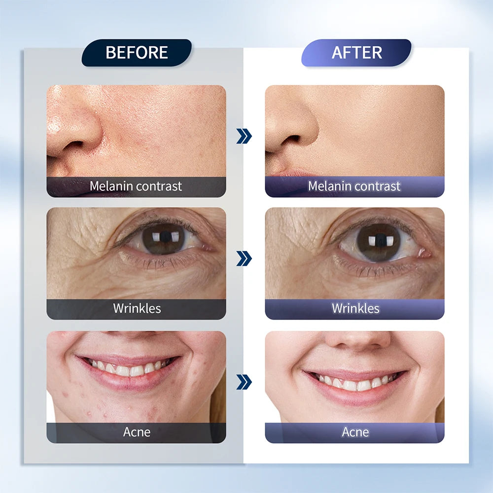 7 Colors LED Photon Machine With Nano Spray | Skin Moisturizing - Wellness and Tech