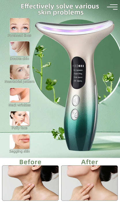 RF Skin Tightening | Face Lifting Device for Wrinkle | Anti Aging Ems Skin Rejuvenation - Wellness and Tech