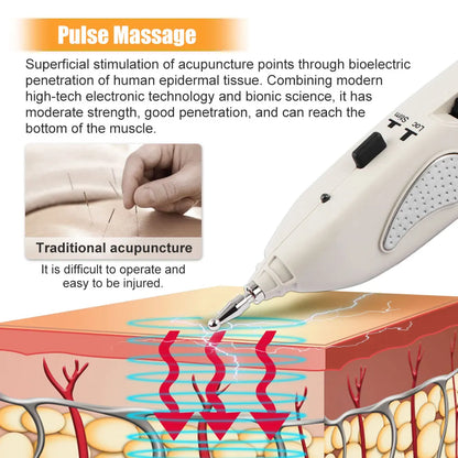 Electronic Acupuncture  Point Detector - Wellness and Tech