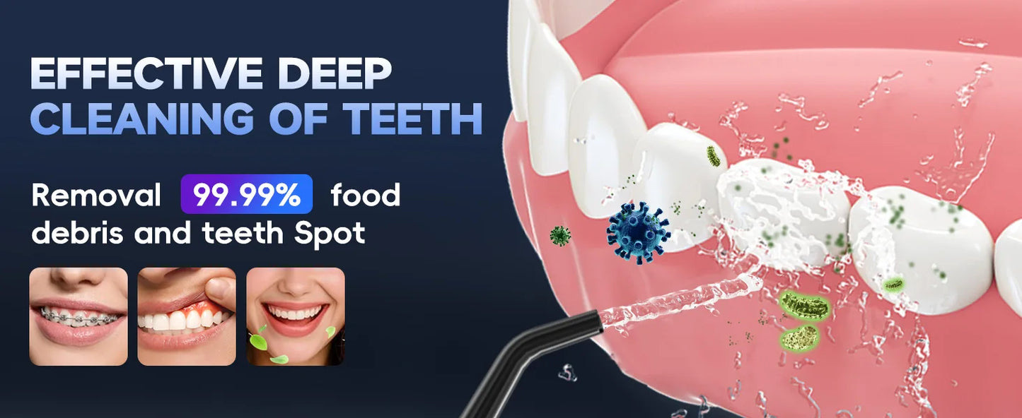 Adult Portable Oral Irrigator - Water Flosser - Wellness and Tech