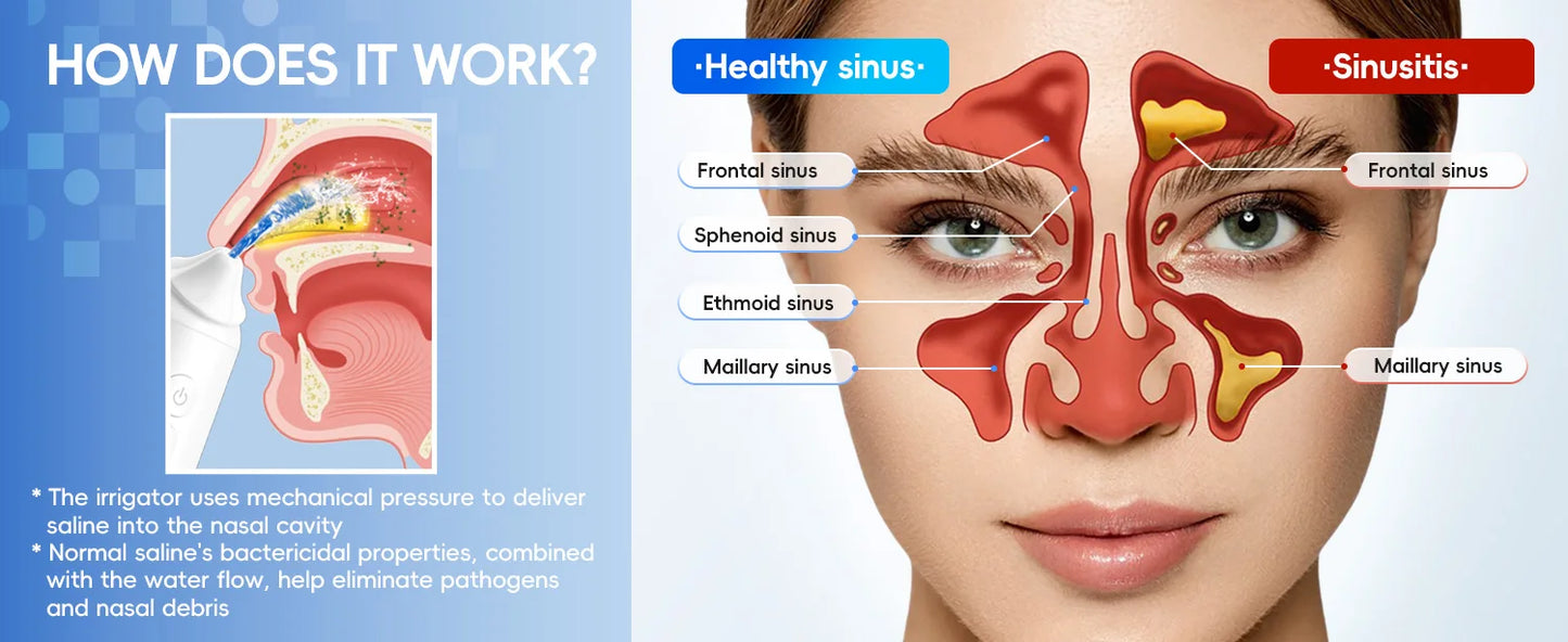 Pulsating Sinus Rinse irrigator - Wellness and Tech