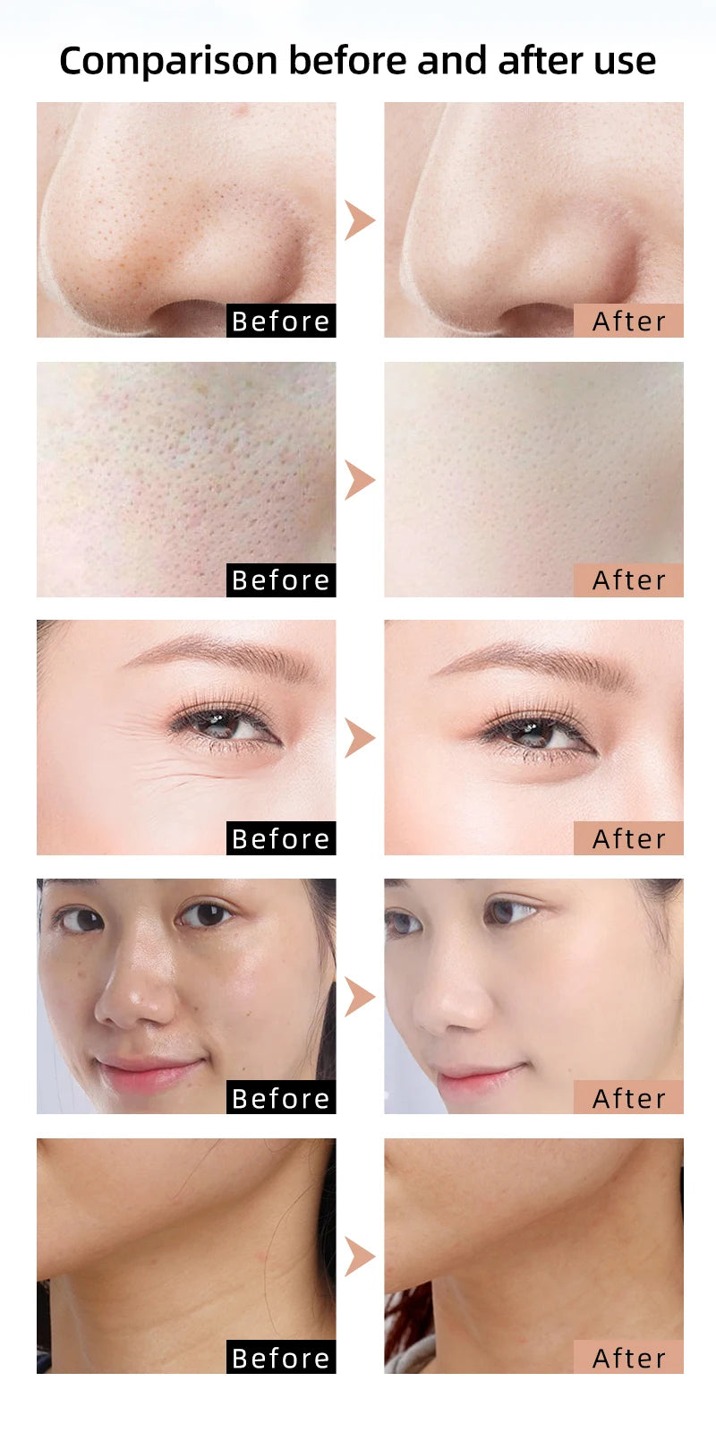 Silicone Infrared Red Light Therapy Face Mask for Skin Care Face Anti-aging - 4 Colours - Wellness and Tech